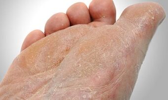 Патеки за пренос на габа за нозе